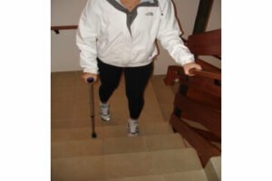 Reabilitação pós Artroplastia do Quadril