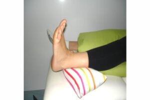 Reabilitação pós Artroplastia do Quadril